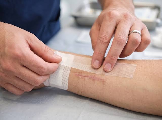 Ongoing Wound Care - Velura Clinic
